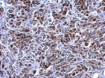 Anti-Cytokeratin 7 antibody [N2C2], Internal used in IHC (Paraffin sections) (IHC-P). GTX110414