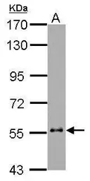 Anti-Cytokeratin 6 antibody used in Western Blot (WB). GTX110426
