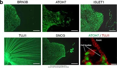 Anti-gamma Synuclein antibody used in IHC (Frozen sections) (IHC-Fr). GTX110483