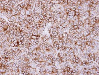 Anti-KIDINS220 antibody [C3], C-term used in IHC (Paraffin sections) (IHC-P). GTX110503
