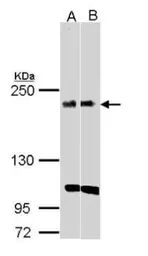 Anti-KIDINS220 antibody [C3], C-term used in Western Blot (WB). GTX110503