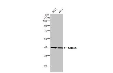 Anti-SMYD5 antibody [C2C3], C-term used in Western Blot (WB). GTX110518