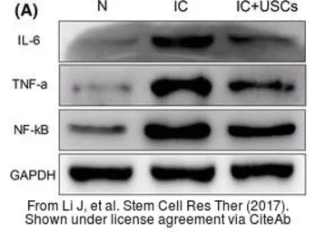 Anti-IL6 antibody used in Western Blot (WB). GTX110527