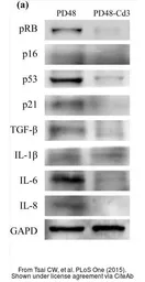 Anti-IL6 antibody used in Western Blot (WB). GTX110527