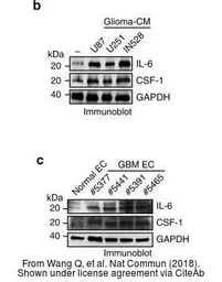 Anti-IL6 antibody used in Western Blot (WB). GTX110527