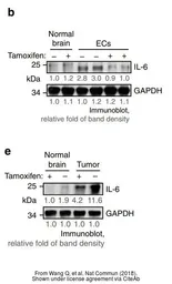 Anti-IL6 antibody used in Western Blot (WB). GTX110527