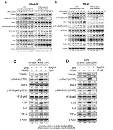 Anti-IL6 antibody used in Western Blot (WB). GTX110527