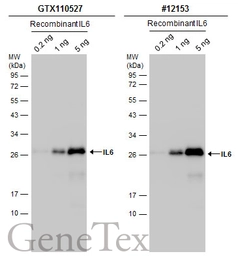 Anti-IL6 antibody used in Western Blot (WB). GTX110527