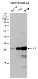 Anti-IL6 antibody used in Western Blot (WB). GTX110527