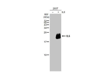 Anti-IL6 antibody used in Western Blot (WB). GTX110527