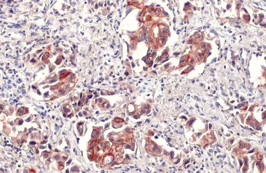Anti-IL6 antibody used in IHC (Paraffin sections) (IHC-P). GTX110527