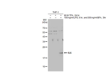 Anti-IL6 antibody used in Western Blot (WB). GTX110527