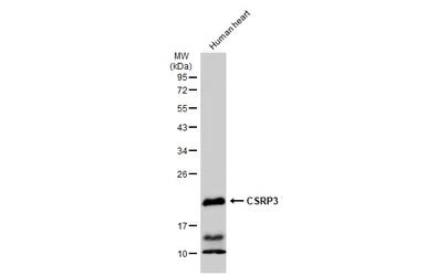 Anti-CSRP3 antibody used in Western Blot (WB). GTX110536