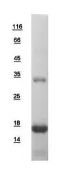 Human PTS protein, His tag. GTX110549-pro