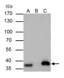 Anti-APE1 antibody used in Immunoprecipitation (IP). GTX110558
