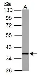 Anti-APE1 antibody used in Western Blot (WB). GTX110558