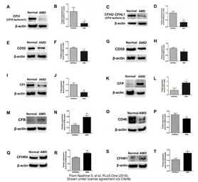 Anti-beta Actin antibody used in Western Blot (WB). GTX110564