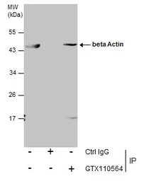 Anti-beta Actin antibody used in Immunoprecipitation (IP). GTX110564