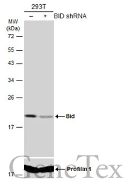 Anti-Bid antibody [N1C3-2] used in Western Blot (WB). GTX110568
