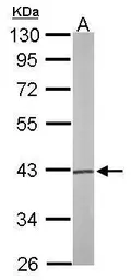 Anti-PSAT1 antibody [N1C3] used in Western Blot (WB). GTX110576