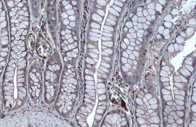 Anti-NFkB p105 antibody used in IHC (Paraffin sections) (IHC-P). GTX110585