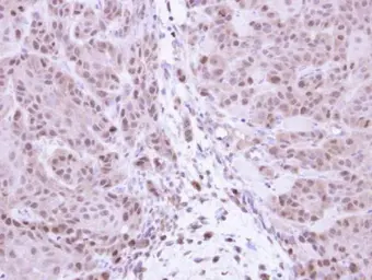 Anti-NFkB p105 antibody used in IHC (Paraffin sections) (IHC-P). GTX110585