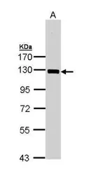 Anti-NFkB p105 antibody used in Western Blot (WB). GTX110585