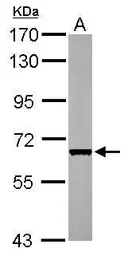 Anti-CDC45L antibody [N3C3] used in Western Blot (WB). GTX110586