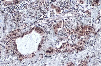 Anti-SP1 antibody used in IHC (Paraffin sections) (IHC-P). GTX110593