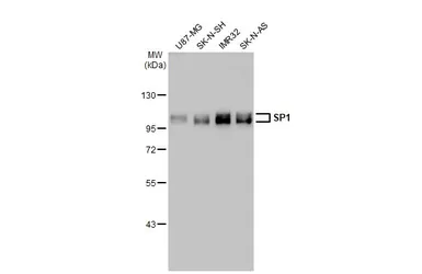 Anti-SP1 antibody used in Western Blot (WB). GTX110593