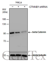 Anti-beta Catenin antibody used in Western Blot (WB). GTX110594