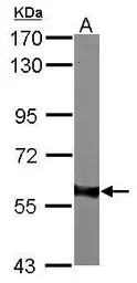 Anti-AKT1 antibody used in Western Blot (WB). GTX110613