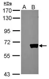 Anti-AKT1 antibody used in Western Blot (WB). GTX110613