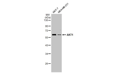 Anti-AKT1 antibody used in Western Blot (WB). GTX110613