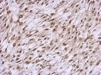 Anti-YY1 antibody used in IHC (Paraffin sections) (IHC-P). GTX110625