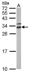 Anti-14-3-3 gamma antibody used in Western Blot (WB). GTX110629