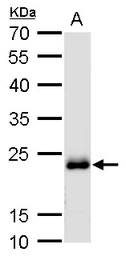 Anti-RAB6A antibody used in Western Blot (WB). GTX110646