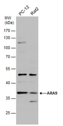 Anti-ARA9 antibody [N1C3] used in Western Blot (WB). GTX110665