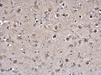 Anti-PPT1 antibody [N1C3] used in IHC (Paraffin sections) (IHC-P). GTX110677