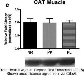 Anti-Catalase antibody used in Western Blot (WB). GTX110704
