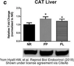 Anti-Catalase antibody used in Western Blot (WB). GTX110704