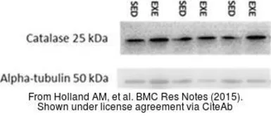 Anti-Catalase antibody used in Western Blot (WB). GTX110704