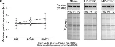 Anti-Catalase antibody used in Western Blot (WB). GTX110704