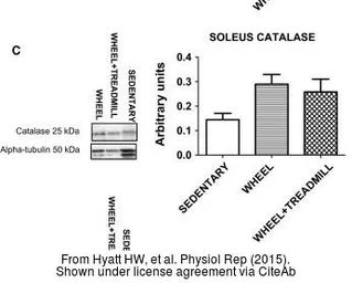 Anti-Catalase antibody used in Western Blot (WB). GTX110704