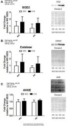 Anti-Catalase antibody used in Western Blot (WB). GTX110704