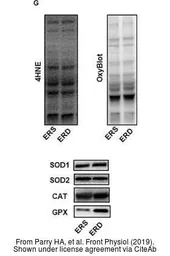Anti-Catalase antibody used in Western Blot (WB). GTX110704