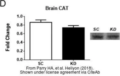 Anti-Catalase antibody used in Western Blot (WB). GTX110704