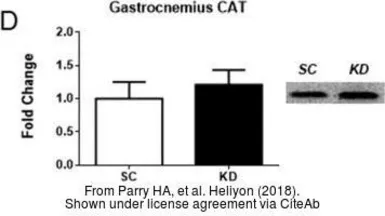 Anti-Catalase antibody used in Western Blot (WB). GTX110704