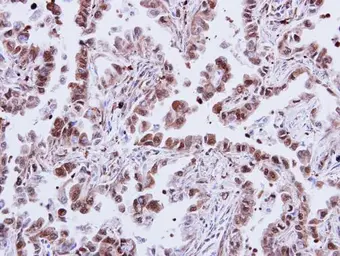 Anti-p38 MAPK antibody [N1C3-2] used in IHC (Paraffin sections) (IHC-P). GTX110720