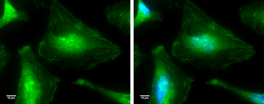Anti-p38 MAPK antibody [N1C3-2] used in Immunocytochemistry/ Immunofluorescence (ICC/IF). GTX110720